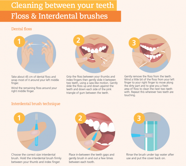 Flossing Glen Eira Dental